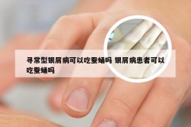 寻常型银屑病可以吃蚕蛹吗 银屑病患者可以吃蚕蛹吗