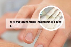 郑州皮肤科医生在哪里 郑州皮肤科哪个医生好