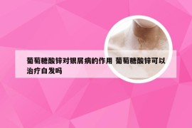葡萄糖酸锌对银屑病的作用 葡萄糖酸锌可以治疗白发吗
