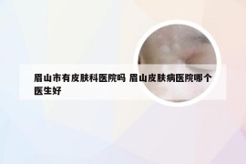 眉山市有皮肤科医院吗 眉山皮肤病医院哪个医生好