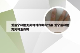 爱达宁和他克莫司对白斑有效果 爱宁达和他克莫司治白斑