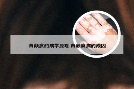 白颠疯的病学原理 白颠疯病的成因