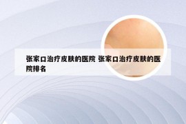 张家口治疗皮肤的医院 张家口治疗皮肤的医院排名