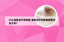 什么温泉治疗皮肤病 温泉治疗皮肤病需要泡多少天?