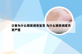 立春为什么银屑病易复发 为什么银屑病夏天更严重