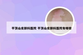 平顶山皮肤科医院 平顶山皮肤科医院有哪些