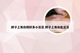 脖子上有白斑好多小豆豆 脖子上有白色豆豆