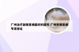 广州治疗副银屑病最好的医院 广州市银屑病专家排名