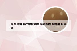 犀牛角粉治疗银屑病最好的医院 犀牛角粉中药