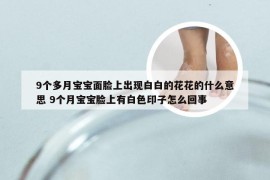 9个多月宝宝面脸上出现白白的花花的什么意思 9个月宝宝脸上有白色印子怎么回事