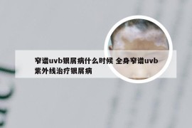 窄谱uvb银屑病什么时候 全身窄谱uvb紫外线治疗银屑病