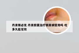 丹青银必克 丹青胶囊治疗银屑病管用吗 吃多久能见效