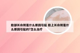 脸部长白斑是什么原因引起 脸上长白斑是什么原因引起的?怎么治疗