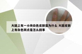 大腿上有一小块白色皮肤是为什么 大腿皮肤上有白色斑点是怎么回事