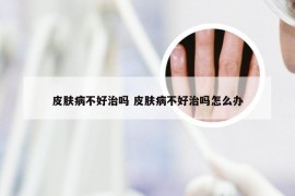 皮肤病不好治吗 皮肤病不好治吗怎么办