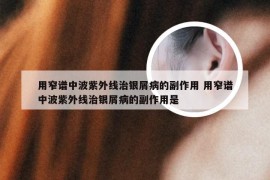 用窄谱中波紫外线治银屑病的副作用 用窄谱中波紫外线治银屑病的副作用是