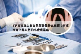 3岁宝宝身上有白色部分是什么东西 3岁宝宝身上起白色的小疙瘩是啥