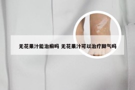 无花果汁能治癣吗 无花果汁可以治疗脚气吗