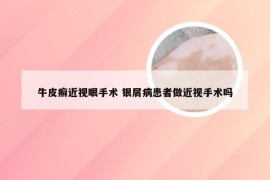 牛皮癣近视眼手术 银屑病患者做近视手术吗