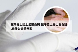 孩子身上脸上出现白斑 孩子脸上身上有白斑,缺什么微量元素