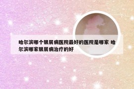 哈尔滨哪个银屑病医院最好的医院是哪家 哈尔滨哪家银屑病治疗的好