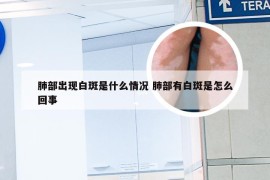 肺部出现白斑是什么情况 肺部有白斑是怎么回事