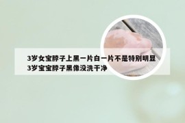 3岁女宝脖子上黑一片白一片不是特别明显 3岁宝宝脖子黑像没洗干净