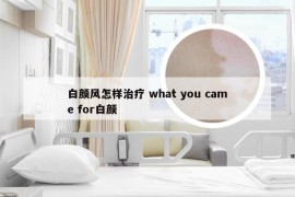 白颜风怎样治疗 what you came for白颜