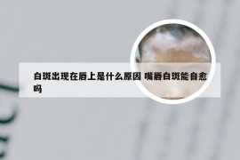 白斑出现在唇上是什么原因 嘴唇白斑能自愈吗