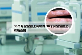 30个月宝宝脸上有块白 30个月宝宝脸上有块白斑