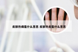 皮肤热病是什么意思 皮肤热皮是什么意思