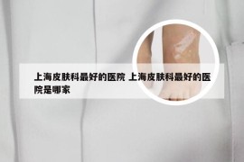 上海皮肤科最好的医院 上海皮肤科最好的医院是哪家