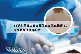 12岁儿童身上有白斑怎么办怎么治疗 12岁小孩身上有小白点