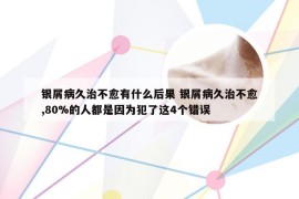银屑病久治不愈有什么后果 银屑病久治不愈,80%的人都是因为犯了这4个错误