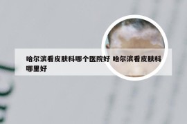 哈尔滨看皮肤科哪个医院好 哈尔滨看皮肤科哪里好