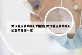 武汉看皮肤病最好的医院 武汉看皮肤病最好的医院是哪一家
