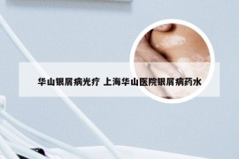 华山银屑病光疗 上海华山医院银屑病药水