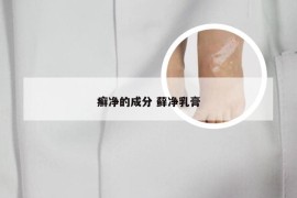 癣净的成分 藓净乳膏