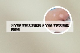 济宁最好的皮肤病医院 济宁最好的皮肤病医院排名