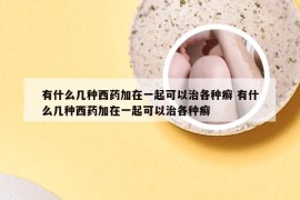 有什么几种西药加在一起可以治各种癣 有什么几种西药加在一起可以治各种癣