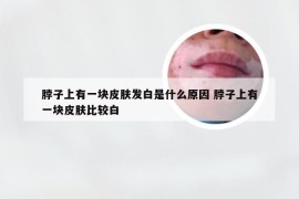 脖子上有一块皮肤发白是什么原因 脖子上有一块皮肤比较白