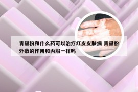 青黛粉和什么药可以治疗红皮皮肤病 青黛粉外敷的作用和内服一样吗