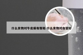 什么食物对牛皮癣有帮助 什么食物对血管好