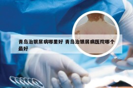 青岛治银屑病哪里好 青岛治银屑病医院哪个最好