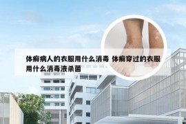体癣病人的衣服用什么消毒 体癣穿过的衣服用什么消毒液杀菌