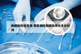 胸腺肽和银屑病 银屑病吃胸腺肽得吃多长时间
