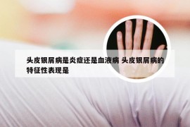 头皮银屑病是炎症还是血液病 头皮银屑病的特征性表现是