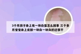 3个月孩子身上有一块白是怎么回事 三个多月宝宝身上皮肤一块白一块白的还很干