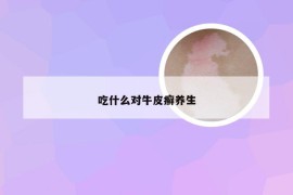 吃什么对牛皮癣养生