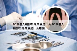 65岁老人腿部出现白点是什么 65岁老人腿部出现白点是什么原因